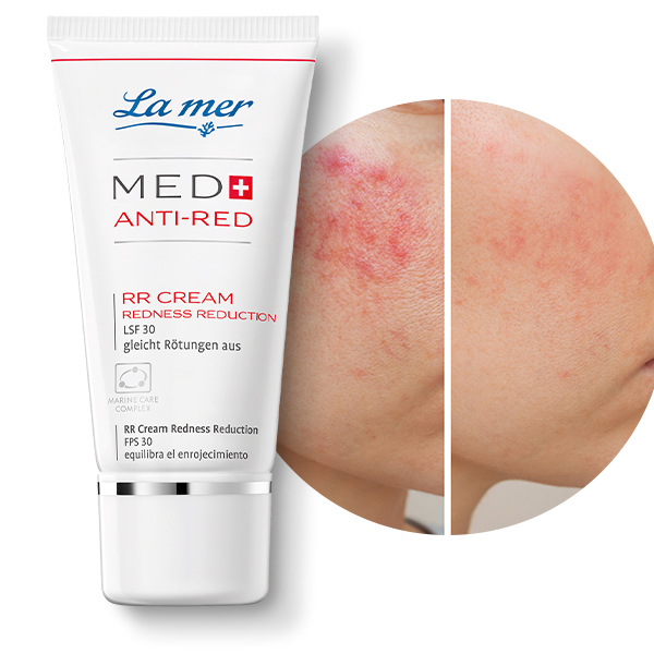Med+ Anti-Red Redness Reduction Cream | LSF 30, deckt Rötungen ab