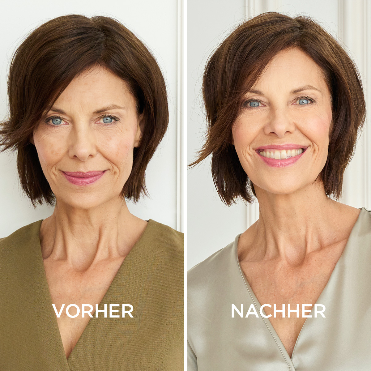 Niacinamid Serum Niacinamid Serum