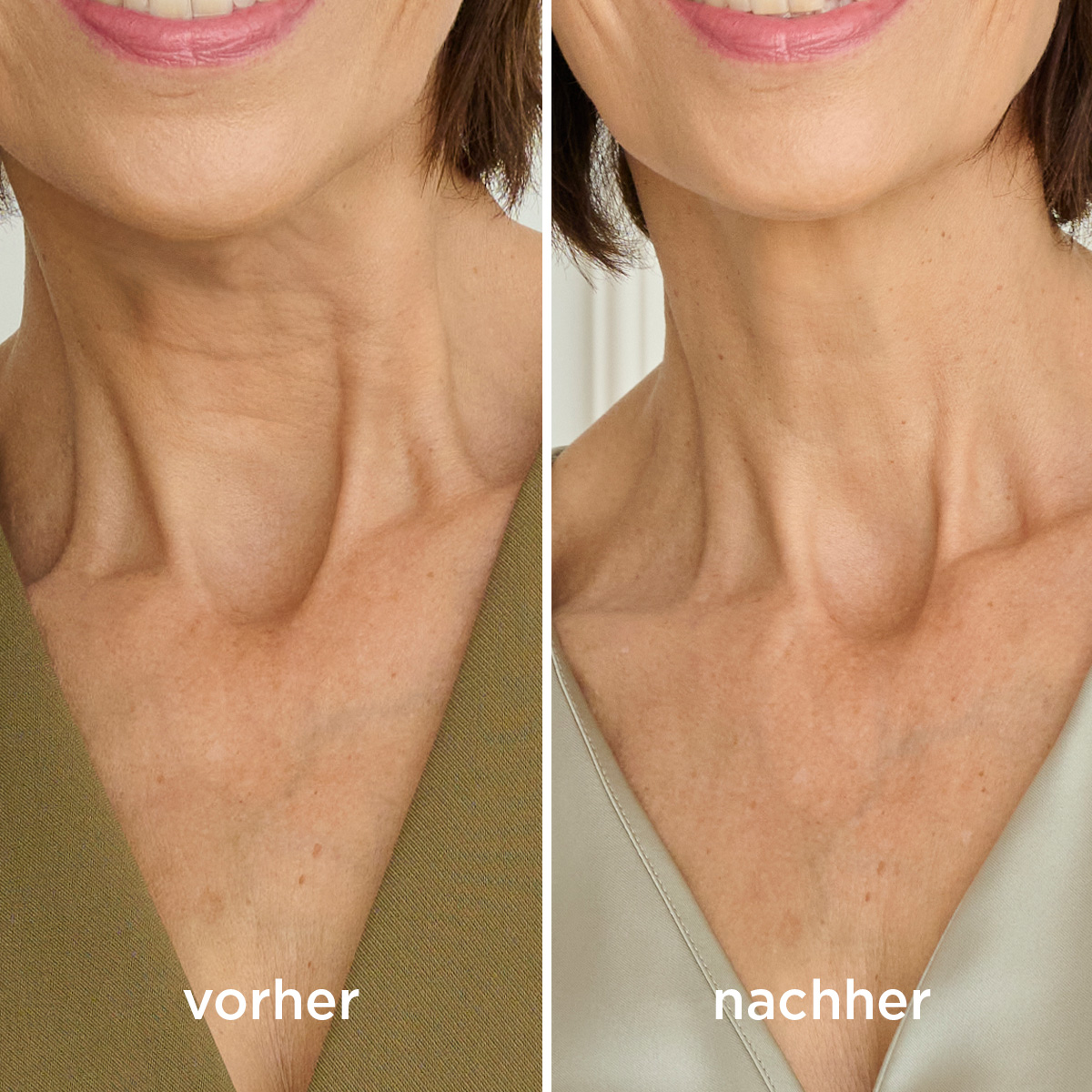 Anti-Age Cream Hals & Dekolleté | Supreme Lift Anti-Age Cream Hals & Dekolleté | Supreme Lift